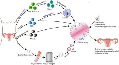 Artificial Ovary for Young Female Breast Cancer Patients